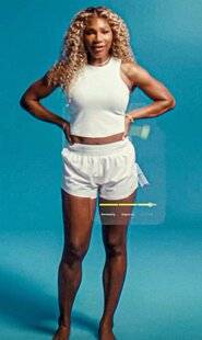 Closer 1055 Serena Williams, injections minceur et gros bad buzz !