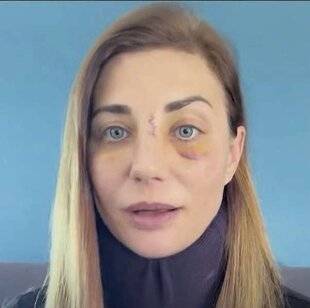 Closer 1069 Ses deux agressions ne sont pas liées