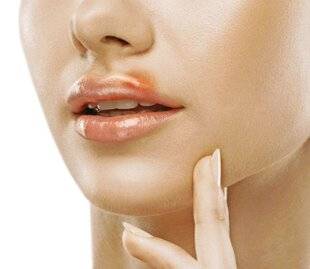 Télé Poche 3120 4 façons de traiter un bouton de fièvre