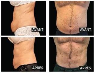 Top Santé 345 LES ONDES ÉLECTROMAGNÉTIQUES pour des abdos-fessiers musclés