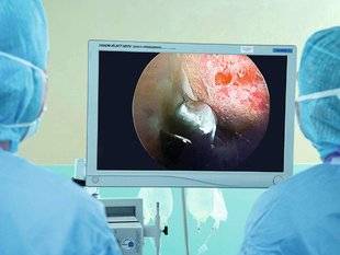 Top Santé 346 Hanche : des alternatives à la pose d'une prothèse
