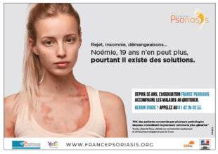 Top Santé 350 Psoriasis, on en parle !