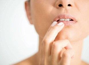 Top Santé 417 MES LÈVRES sont abîmées