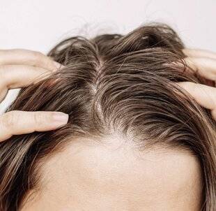 Top Santé 423 LE CUIR CHEVELU en question