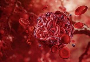 Top Santé 423 QUELLES PRÉCAUTIONS PRENDRE AVEC LES ANTICOAGULANTS ?