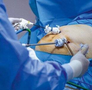 Top Santé 425 UNE NOUVELLE TECHNIQUE PLUS EFFICACE