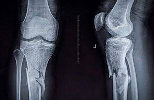 Top Santé 425 UN REPÉRAGE DÈS LES URGENCES