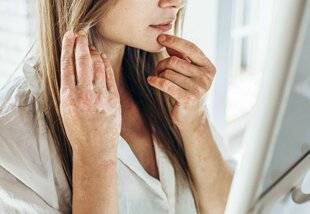 Top Santé 426 LA PEAU Reflet de notre état de santé