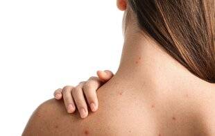 Top Santé 427 Attention aux cicatrices