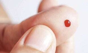 Top Santé 428 ALZHEIMER : VERS UN DÉPISTAGE PRÉCOCE PAR SIMPLE PIQÛRE AU DOIGT ?