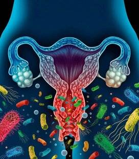 Top Santé 430 Vaginose bactérienne : des probiotiques contre les récidives ?