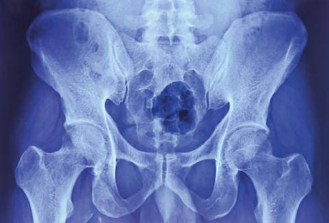 Top Santé 434 DOULEURS DU BASSIN Les identifier pour mieux les atténuer