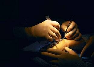 Hors-Séries 324 QUAND FAUT-IL OPÉRER ?