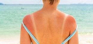 Pleine Vie 459 Une crème pour soigner COUPS DE SOLEIL ET BRÛLURES