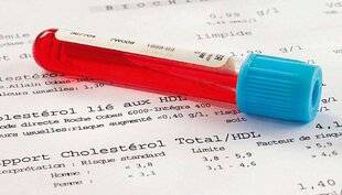 Pleine Vie 473 DÉCRYPTER LE BILAN LIPIDIQUE