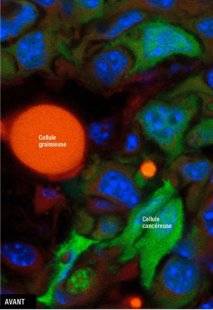 Science & Vie 1219 CHANGER L'ÉTAT DE CELLULES CANCÉREUSES EST POSSIBLE
