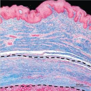 Science & Vie 1221 LES VEINES ARTIFICIELLES ONT FAIT LEURS PREUVES