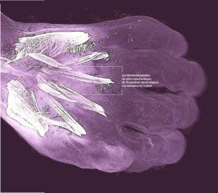 Science & Vie 1227 DES MUSCLES TRANSITOIRES APPARAISSENT CHEZ L'EMBRYON