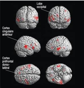 Science & Vie 1228 Que se passe-t-il dans le cerveau lors d'une hypnose ?