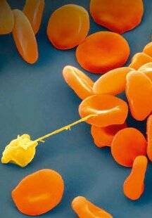 Science & Vie 1284 L'HUMAIN PROPAGEAIT LE PALUDISME DANS LE MONDE