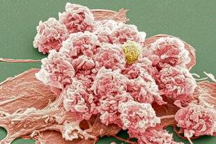 Science & Vie 1292 LES MACROPHAGES SONT DES CHAMPIONS DU RECYCLAGE