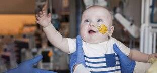 Science & Vie 1294 Le jour où l'édition du génome a servi à soigner un bébé