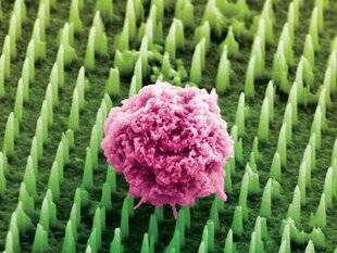 Science & Vie 1296 UN PATCH POURRAIT REMPLACER LES BIOPSIES