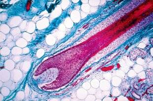 Science & Vie 1300 Pourquoi les hommes perdent-ils plus leurs cheveux que les femmes ?