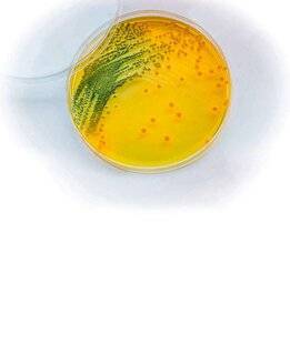 Science & Vie 1303 En mer, gare aux Vibrio