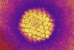 Science & Vie 1304 À quoi est due l'apparition de verrues sur la peau ?