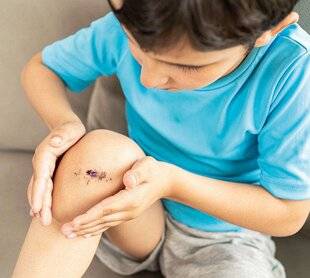 Science & Vie Découvertes 332 APRÈS UNE BLESSURE, COMMENT LA PEAU CICATRISE-T-ELLE ?