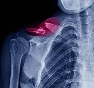 Hors-Séries 175 Cette colle va te scotcher !