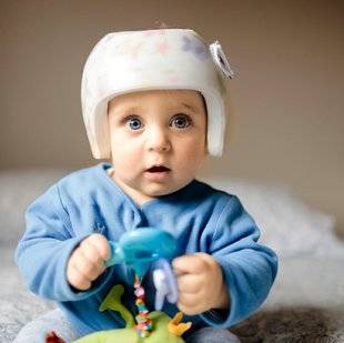 Science & Vous par Science et Vie 40 Que faire si mon bébé a la tête plate ?