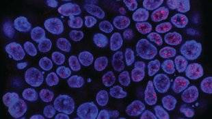 Science & Vous par Science et Vie 40 Une bactérie peut-elle provoquer un cancer ?