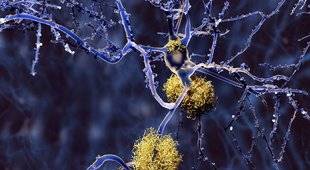 Science & Vous par Science et Vie 40 Peut-on freiner la maladie d'Alzheimer ?