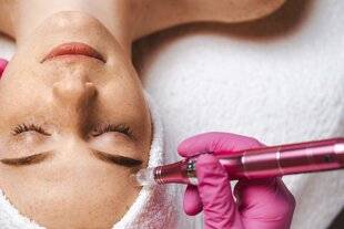 Hors Série 63 MICRONEEDLING UNE PEAU (VRAIMENT) RAFRAÎCHIE SANS BISTOURI !